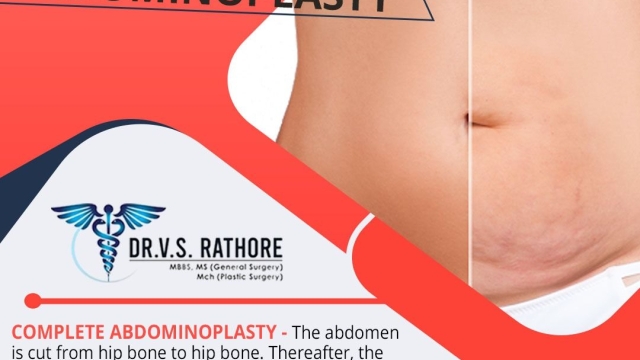 The Skinny on Liposuction: Sculpting Your Way to a New You