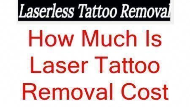 Answers With A Laser Tattoo Removal Questions