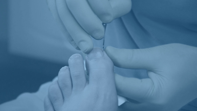 Step into Healthy Feet: Discover the Best Local Podiatrist in Forest Hills!