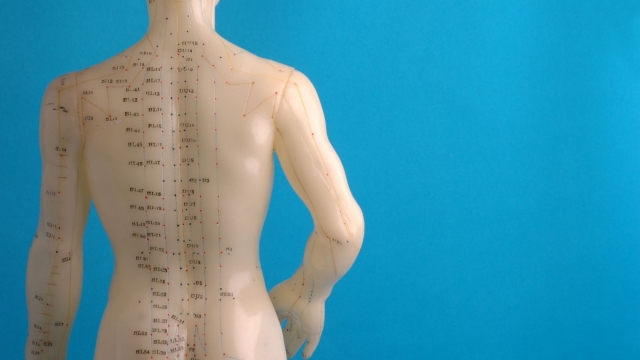 The Ancient Art of Acupuncture: Discovering the Needle’s Healing Power